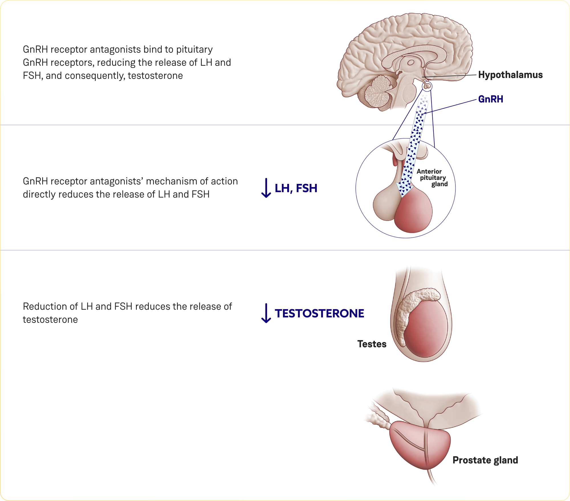 Diagram showing the GnRH antagonist mechanism of action