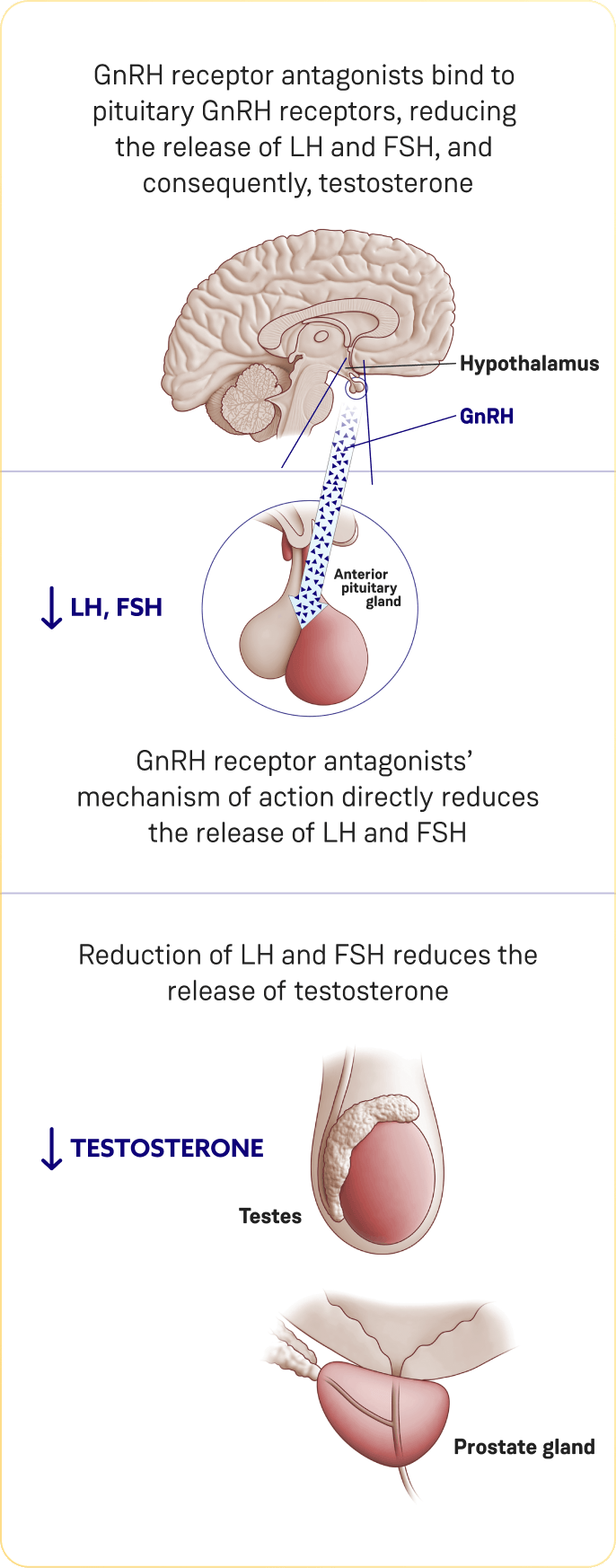 Diagram showing the GnRH antagonist mechanism of action